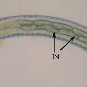 Oesophagostomum_L3_ZAF3.jpg