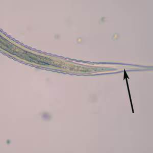 Oesophagostomum_L3_ZAF4.jpg