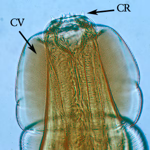 Oesophagostamum_BeaverC.jpg