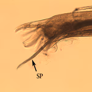 Oesophagostomum_BAM_bursa1.jpg