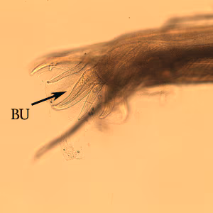 Oesophagostomum_BAM_bursa2.jpg