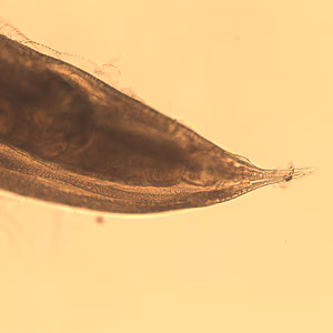 Oesophagostomum_BAM_female.jpg