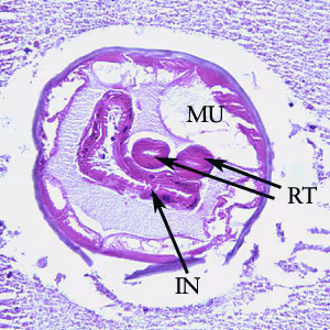 Oesophagostomum_BAM_200xA.jpg