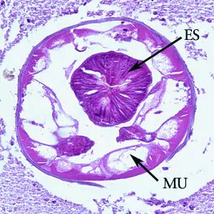 Oesophagostomum_BAM_200xB.jpg