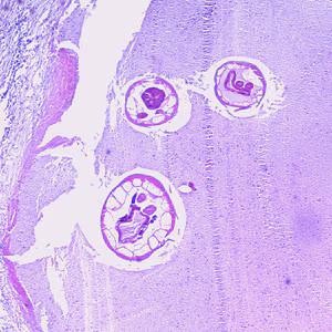 Oesophagostomum_BAM_40x.jpg
