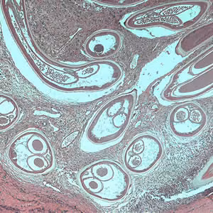 Ovolvulus_tissue1b.jpg