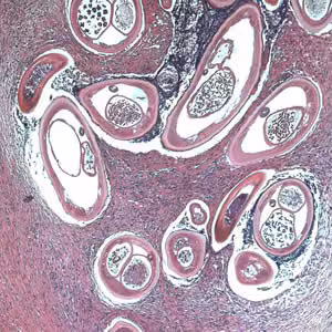 Ovolvulus_tissue2b.jpg