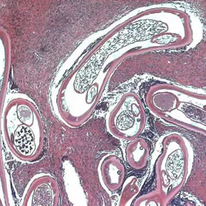 Ovolvulus_tissue3b.jpg