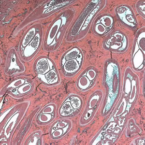 Ovolvulus_tissue4a.jpg