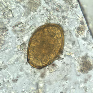 P_westermani_egg_wtmt_BAM1.jpg