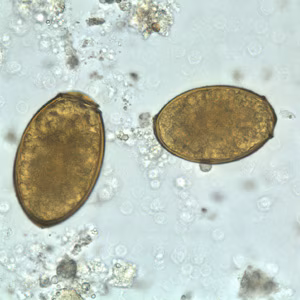 P_westermani_egg_wtmt_BAM2.jpg