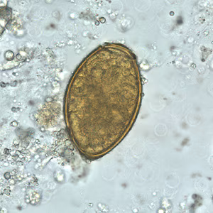 P_westermani_egg_wtmt_BAM3.jpg