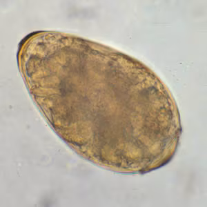 Paragonimus_egg_wtmt.jpg