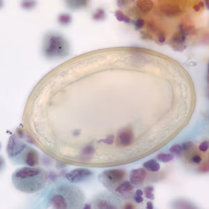 P_kellicottii_BAL1000x_Prokop.jpg