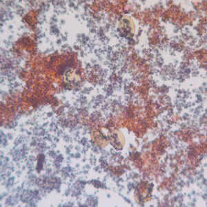P_kellicottii_BAL100x_Prokop.jpg