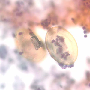 P_kellicottii_BAL400x_Prokop.jpg