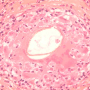 P_kellicottii_OK400x_ProkopA.jpg