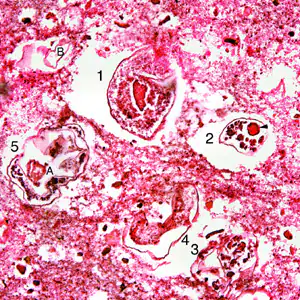 P_kellicotti_lung1.jpg