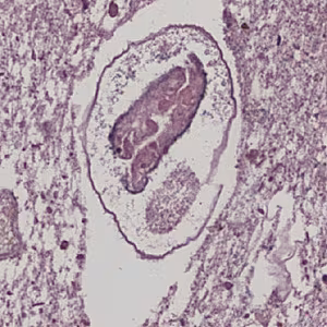 P_kellicotti_lung2.jpg