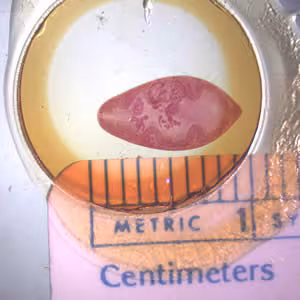 Paragonimus_adult_hematoxylin.jpg