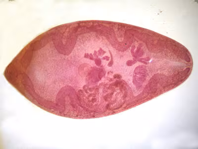 Paragonimus_adult_hematoxylin2.jpg