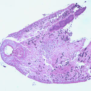 Paragonimus_oral_sucker.jpg