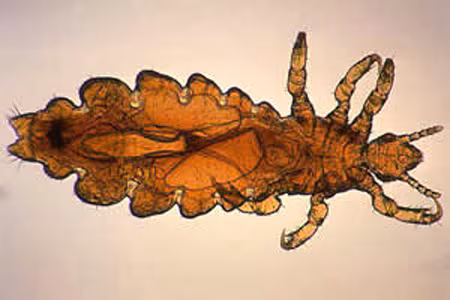 P_h_capitis_female1.jpg