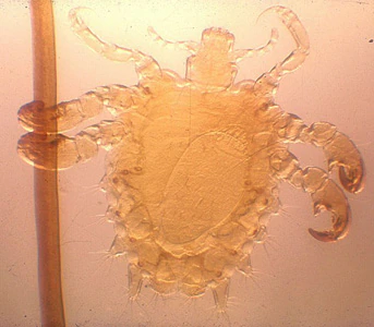 Phthirus_pubis_female.jpg