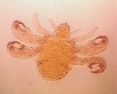 Phthirus_pubis_nymph.jpg