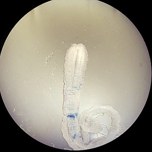 Sparganum_OK_B.jpg