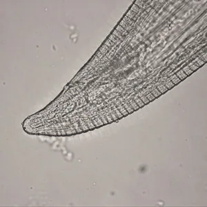 Thelazia_posterior_HB1.jpg