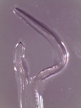 Figure b thelaziasis image