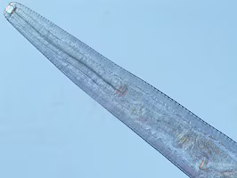 Figure C Thelaziasis