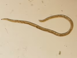 FigureH thelaziasis image