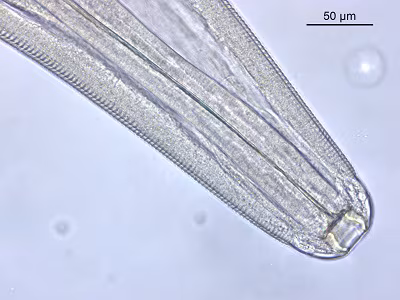 Tcallipaeda_B Figure B: Anterior of Thelazia callipaeda showing wide, moderate depth, buccal cavity and prominent tightly spaced cuticular striations.