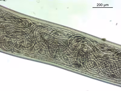Tcallipaeda_D Figure D: Mid-section of adult female Thelazia callipaeda showing live larvae in utero