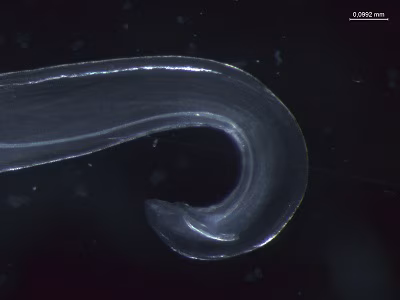 Tcallipaeda_E Figure E: Posterior of adult male Thelazia callipaeda showing spicules (Nomarsky phase contrast).