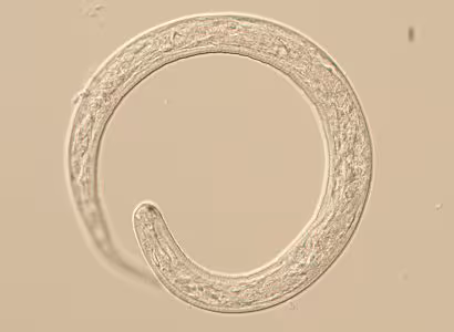 LarvaeA Figure A: L1 larva of Thelazia sp., likely T. callipaeda based on the patient’s travel history. L1 larvae measure up to 400 µm long and 13.5 µm wide. While not visible on this specimen, normally larvae are passed encased in a shell membrane.