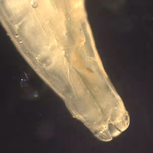 Figure B