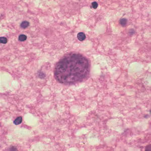 T_gondii_cyst_brain.jpg