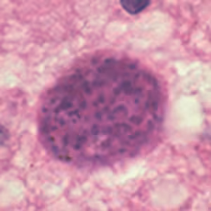 T_gondii_cyst_brain2.jpg