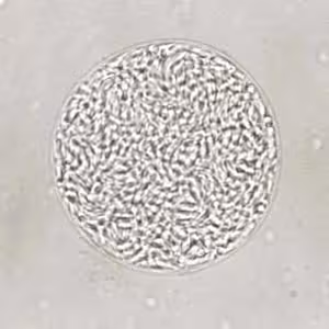 T_gondii_cyst_unstained.jpg