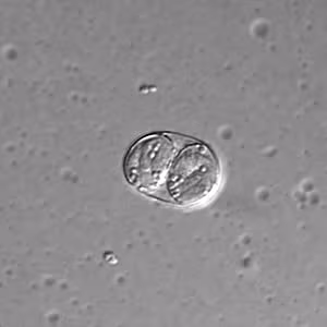 T_gondii_DIC_sporu_100X1.jpg