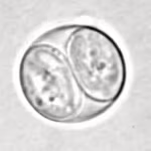 T_gondii_oocyst_sporu.jpg