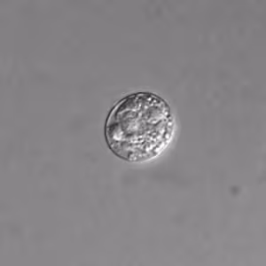 T_gondii_DIC_unsporu_100X1.jpg
