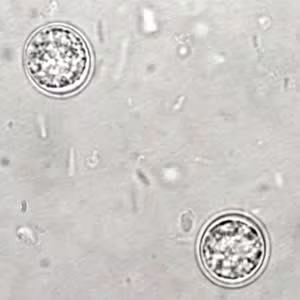 T_gondii_oocyst_upsporu.jpg
