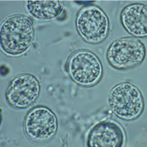 T_gondii_ooycst_fecalfloa.jpg