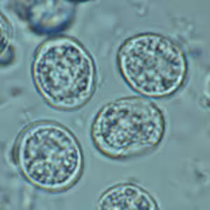 T_gondii_ooycst_fecalfloat2.jpg