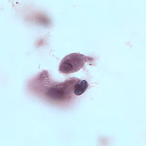 T_vaginalis_troph_BAM1.jpg