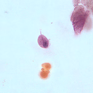 T_vaginalis_troph_BAM5.jpg
